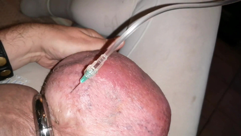 Monster_Meat_: Наповнення глюкозою 1liter