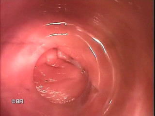 Pegging insertion: File bizzarri 163