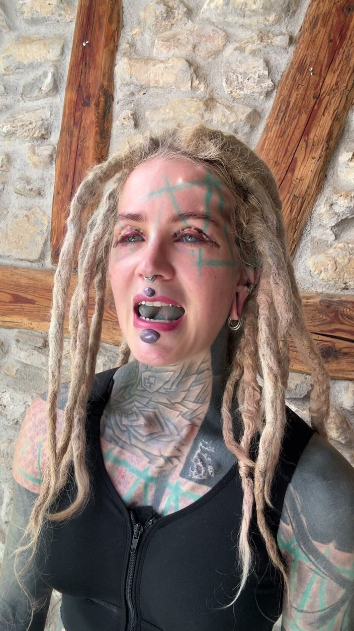 Anuskatzz: Ziua 5 după țâțele mele și chirurgia blephoplastiei superioare