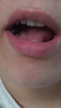 Moja przyrodnia siostra gigantka gra dentystę z małym przyrodnim bratem,