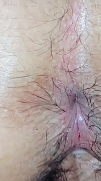 Accident Anal