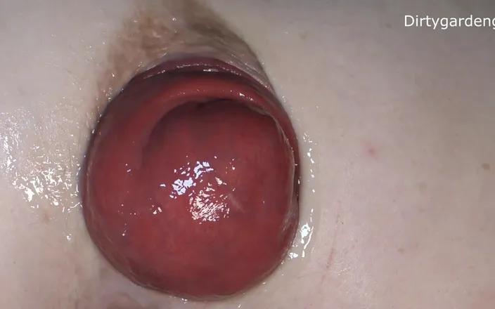 Dirtygardengirl VOD: More Anal Spreader
