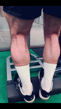 My Legs