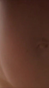 いたずら、妊娠中、とても角質