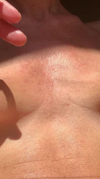 Peitos brincam ao sol