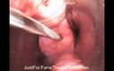 TripleXTransMan: Extreme Cervix Penetration, Sounds, Speculum, Uterus Dilation