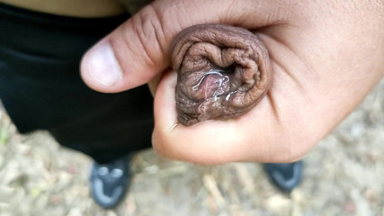 Idmir Sugary: Outdoor Slowmotion Foreskin Filling with Piss - Filled Foreskin Like Balloon...