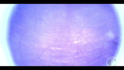 Lina Free: Magnifique à l’intérieur de ma vessie complète avec l’endoscope !