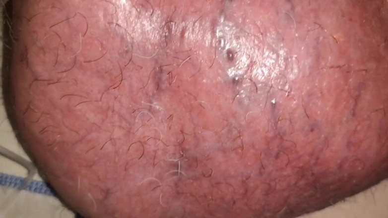 Monster_Meat_: Una massiccia coltivazione del glucosio