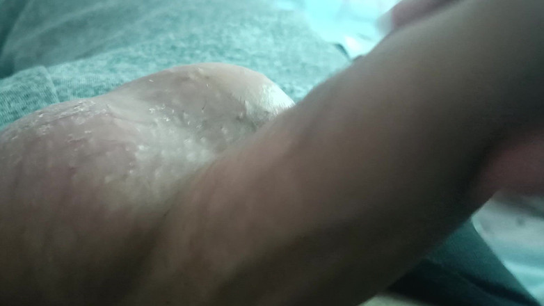 Hardy: POV av Slopy Dick