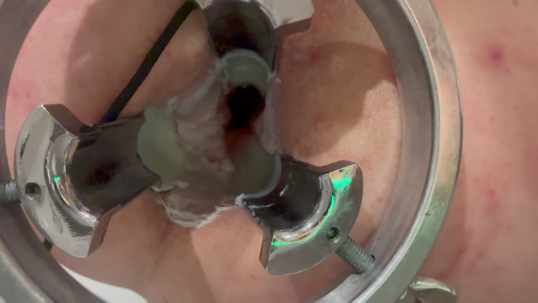 No limit cbt slave: 熱いキャンドルワックスを尻に注ぐ