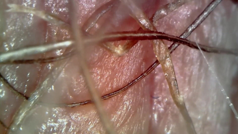 Nicoletta Embassi: Bộ sưu tập giật gân của những con xì hơi...