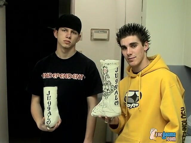 Toegasms: Foot Cast for Poor Evan