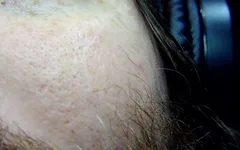 New Close-up with a New Camera