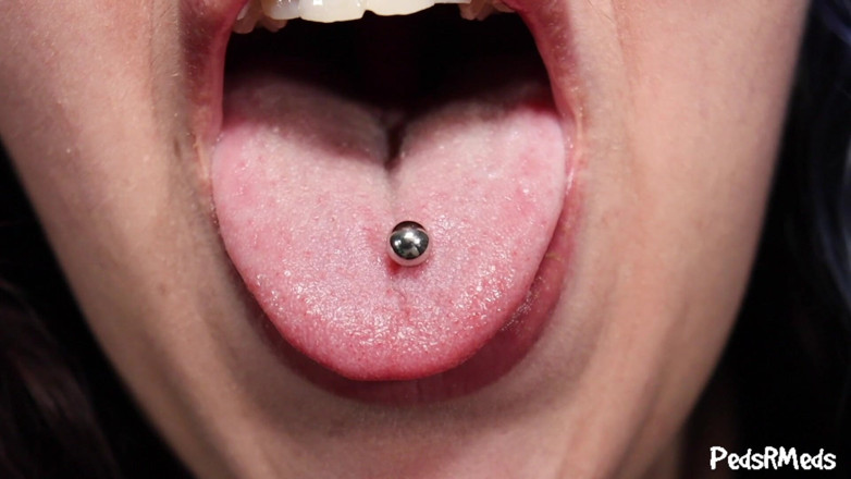 PedsRMeds: Tuffie Somethings Stuck in My Throat
