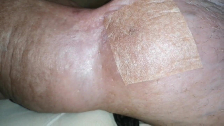 Monster_Meat_: Swollen obscene filled silicone filled meat