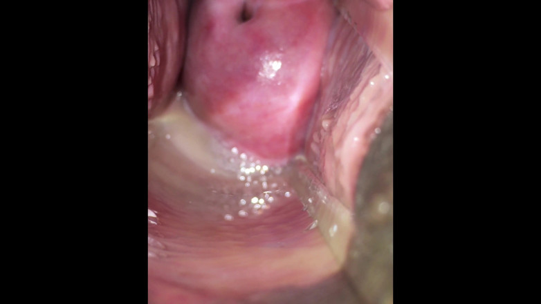 VeeVee Vixen: Sperma livmoderhals insemination