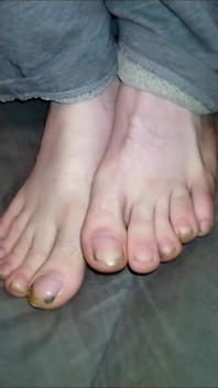 Foot Fancies