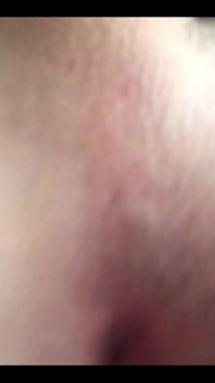 My hole today