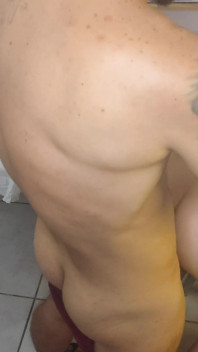Erection in the Ward