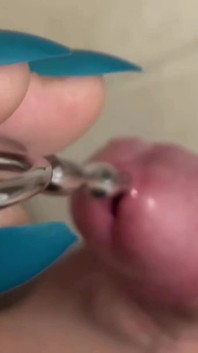 Inserimento uretrale