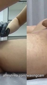 #36 男性脱毛（完整）