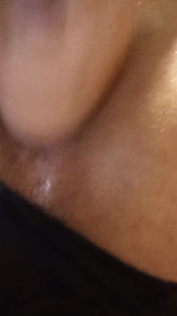 My Little Ass Hole