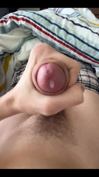 Brudna kamera