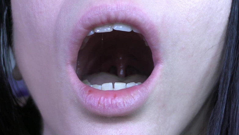 Quinn brooks: My Uvula