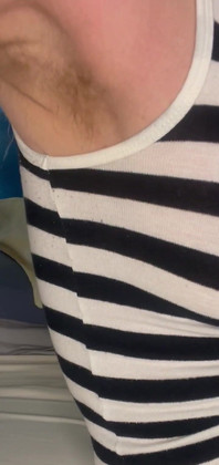 Cspot Showing Armpit Hair