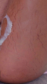 The Sneaky Link Always Comes Correct