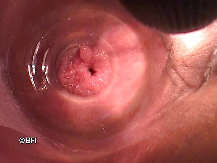 Pegging insertion: File bizzarri 162