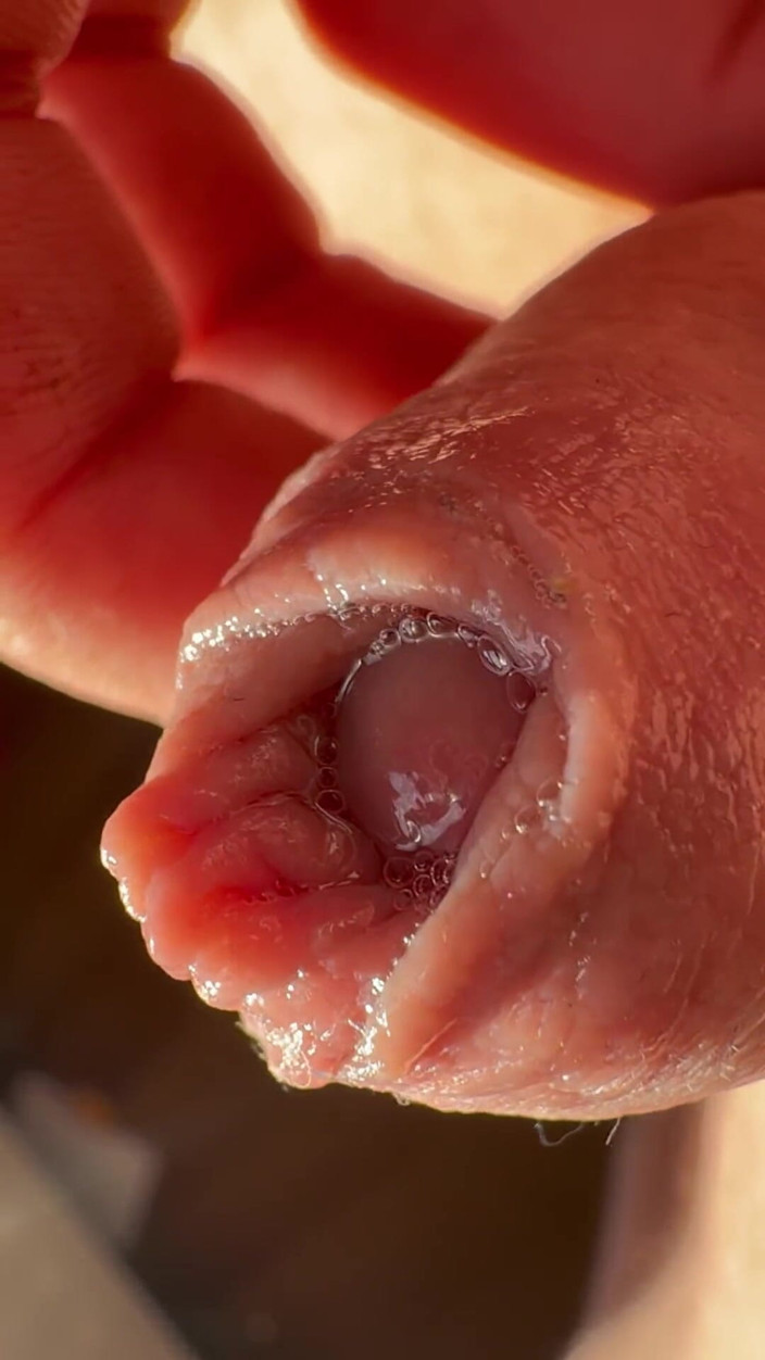 Nalekhome: Makro ıslak sünnetik yarak