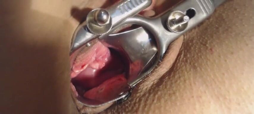 Putarankahotmilf: Ass fuck with speculum in my pussy, cervix show