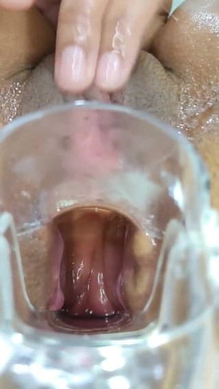Xamy_97: Espansione anale con speculum