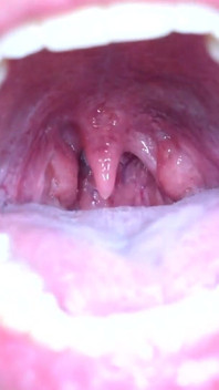 Tongue Fetish