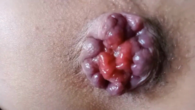 Nadin: A Plug and Balls in My Ass at the Same...