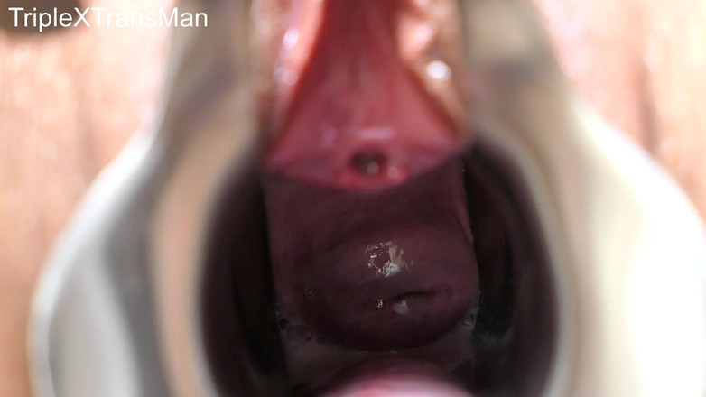 TripleXTransMan: 내 자궁 경부를 관통!