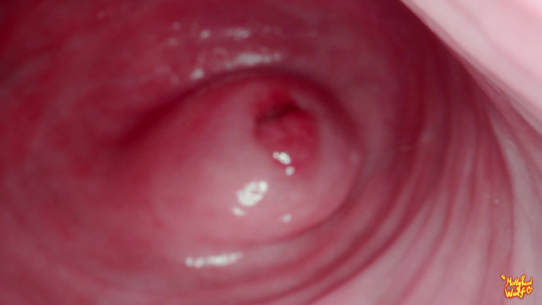 MollyRedWolf: Ei meio-irmão! Vamos brincar com o ginecologista? Ginecologista, Endoscopia - Mollyredwolf