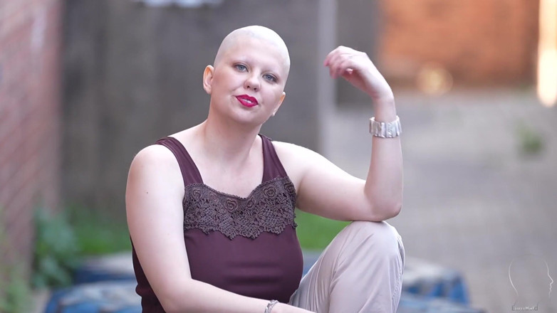 Euro Bald: Anne's New Haircut