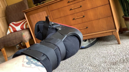 City hog: broken leg fetish