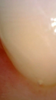 Kiểm tra miệng nội soi y tế: Nhai kẹo cao su, răng cực đoan & macro lưỡi