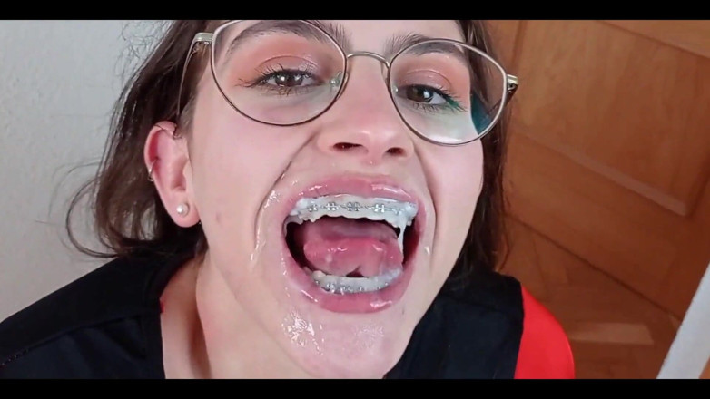 Shanaxnow: Please Cum on My Braces Dirty Talking Teen Blowjob. Shanaxnow