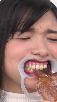 Observation des dents dents naturelles, mais des caries potentielles trouvées ! La beauté jouit quand ses dents sont tapées - Suzu Shiratori