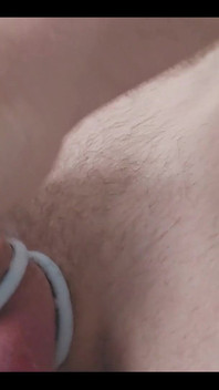 Electro Cock Shock Experiment