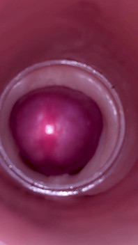 Ženské inseminace - vnitřní kamera zachycuje hlubokou mužskou ejakulaci