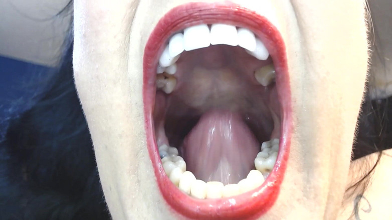 Abby Anna: Bên trong miệng lớn của tôi lưỡi răng Uvula