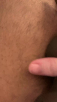 Călcare de testicule