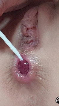 Sweet Anal Lollipops