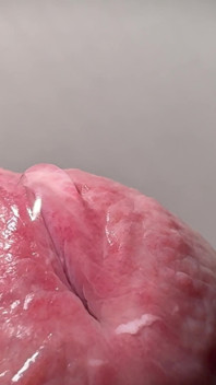 Penis tropft